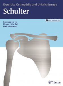 expertise schulter