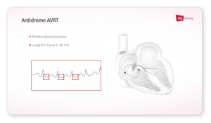 Ausschnitt aus ekg.training