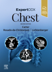 Bücher für den Facharzt für Radiologie: ExpertDDx: Chest Englisches Fachbuch für die Radiologie