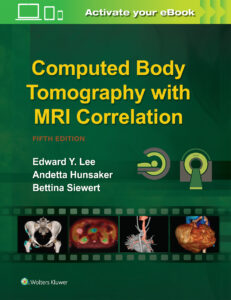 Bücher für den Facharzt für Radiologie: Computed Body Tomography with MRI Correlation Englisches Fachbücher für die Radiologie